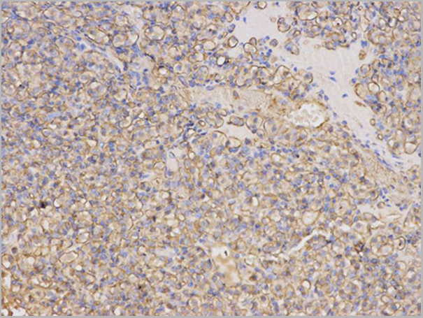 product-image-AAA29697_IHC2.jpg