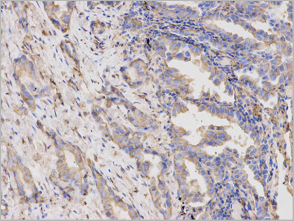 product-image-AAA29697_IHC3.jpg