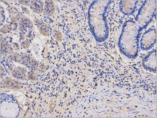 product-image-AAA29697_IHC5.jpg