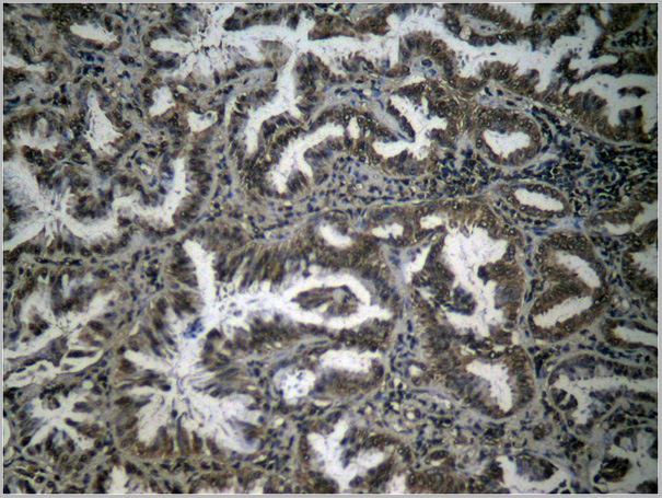 product-image-AAA29703_IHC5.jpg
