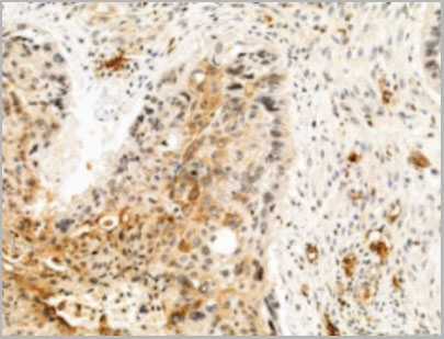 product-image-AAA29710_IHC2.jpg