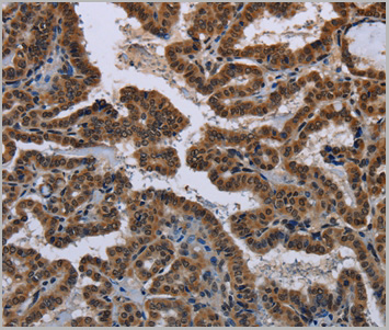 product-image-AAA29712_IHC.jpg