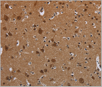 product-image-AAA29712_IHC2.jpg