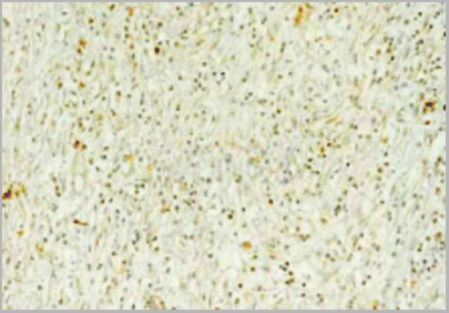 product-image-AAA29712_IHC3.jpg
