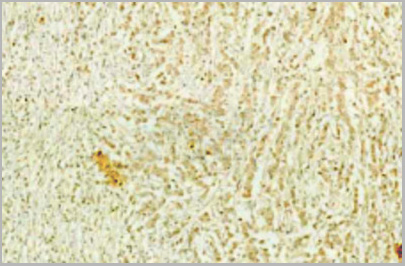 product-image-AAA29712_IHC4.jpg
