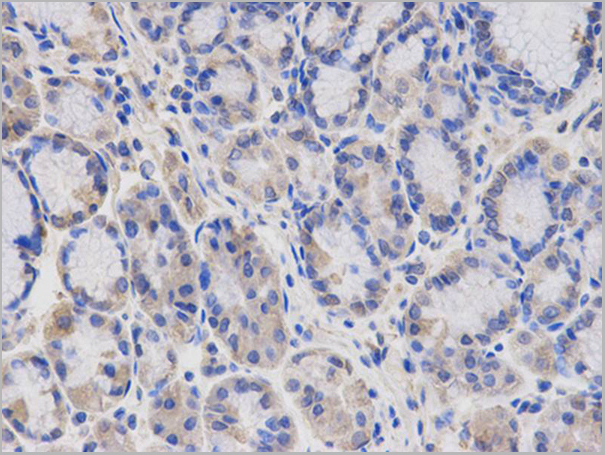 product-image-AAA29714_IHC4.jpg