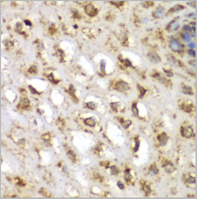 product-image-AAA29714_IHC5.jpg