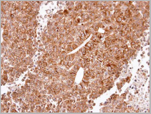 product-image-AAA29716_IHC2.jpg