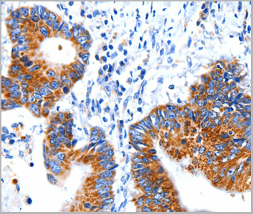 product-image-AAA29717_IHC2.jpg