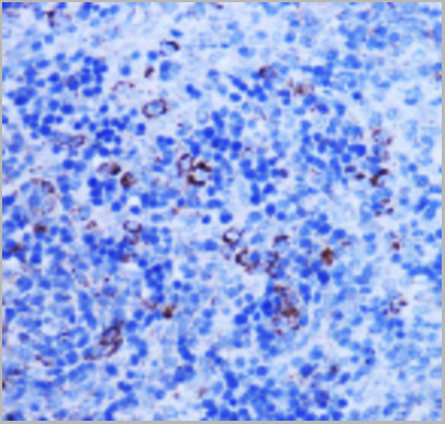 product-image-AAA29719_IHC2.jpg