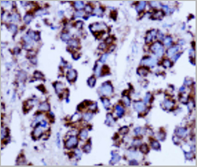 product-image-AAA29719_IHC3.jpg