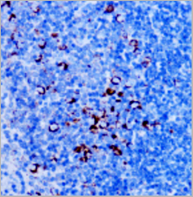 product-image-AAA29719_IHC4.jpg