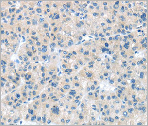 product-image-AAA29720_IHC2.jpg