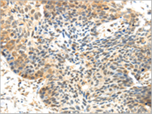 product-image-AAA29724_IHC2.jpg