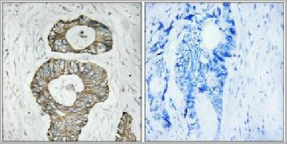 product-image-AAA29724_IHC5.jpg