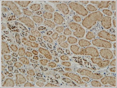 product-image-AAA29724_IHC6.jpg