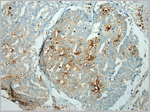 product-image-AAA29725_IHC.jpg