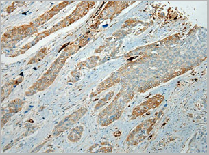 product-image-AAA29725_IHC2.jpg