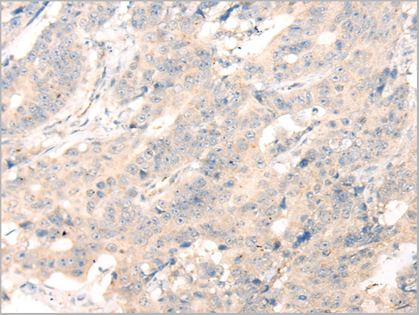 product-image-AAA29726_IHC2.jpg