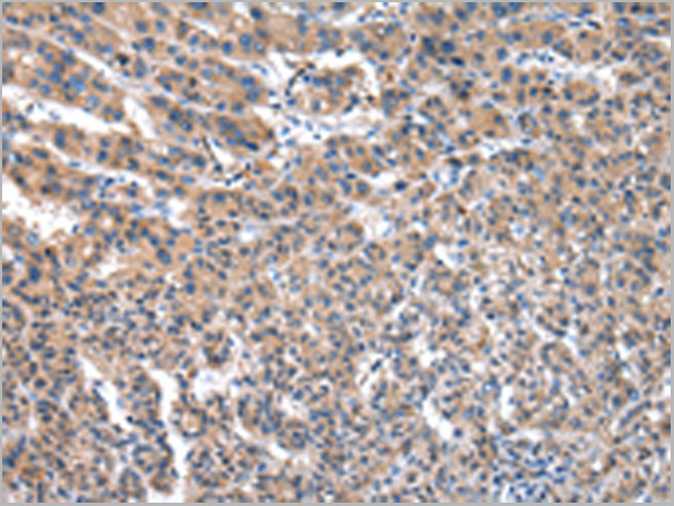 product-image-AAA29727_IHC2.jpg