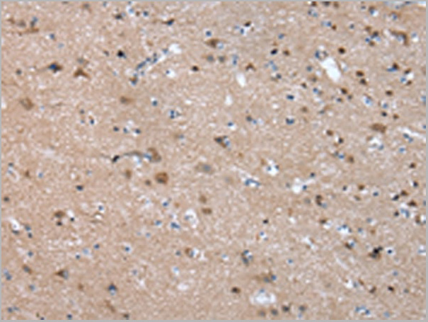 product-image-AAA29727_IHC3.jpg