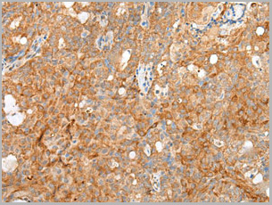 product-image-AAA29729_IHC.jpg