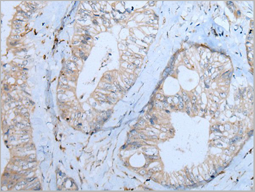 product-image-AAA29730_IHC2.jpg