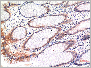 product-image-AAA29732_IHC.jpg
