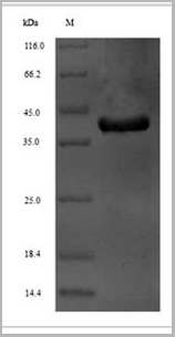 product-image-AAA29733_SDS_PAGE.jpg