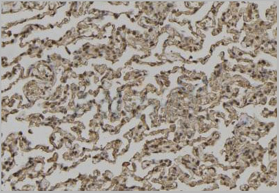 product-image-AAA29758_IHC2.jpg