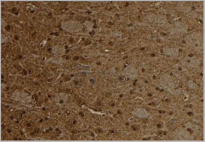 product-image-AAA29758_IHC3.jpg