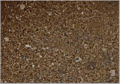 product-image-AAA29758_IHC4.jpg