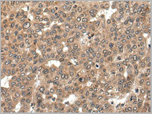 product-image-AAA29759_IHC2.jpg
