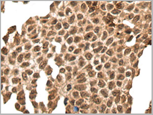 product-image-AAA29759_IHC3.jpg