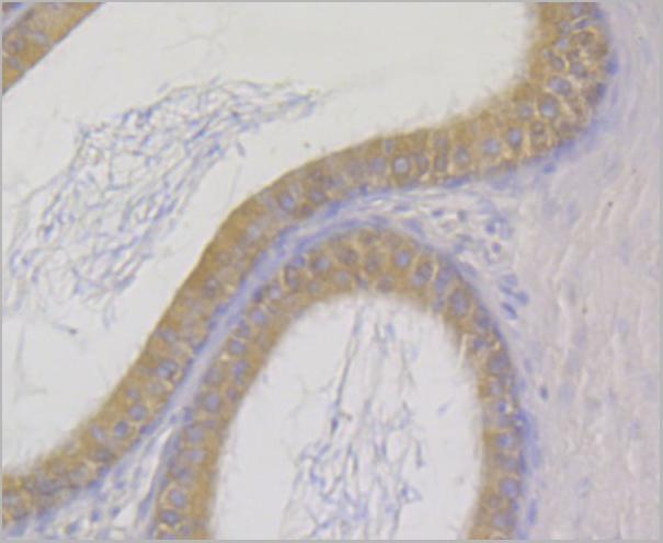 product-image-AAA29941_IHC2.jpg