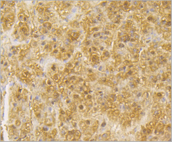 product-image-AAA29941_IHC3.jpg