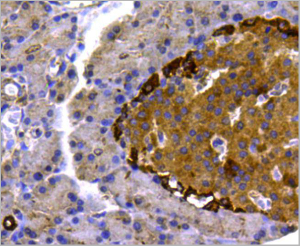 product-image-AAA29952_IHC2.jpg