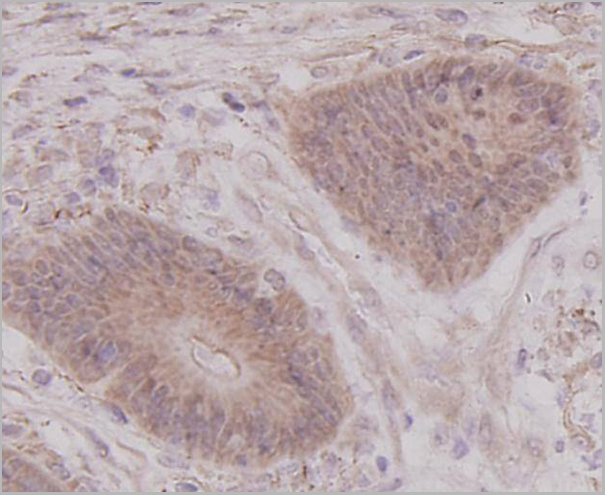 product-image-AAA29952_IHC3.jpg