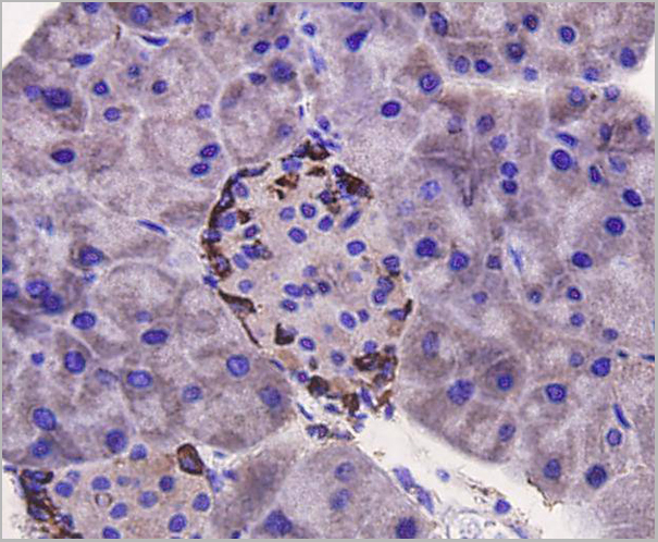 product-image-AAA29952_IHC5.jpg