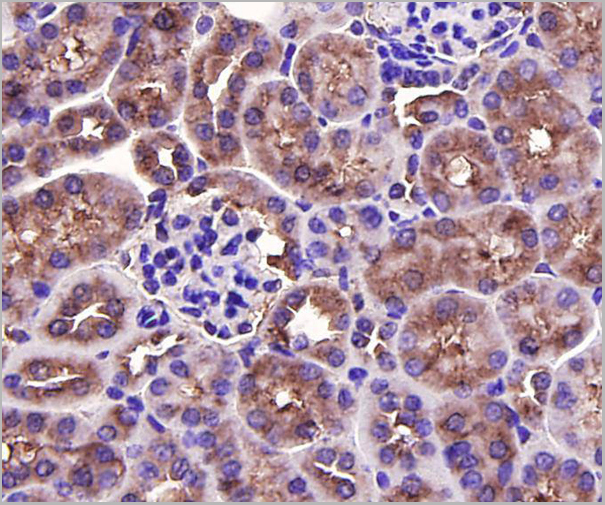 product-image-AAA29953_IHC4.jpg