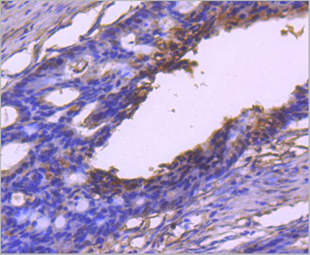 product-image-AAA30018_IHC.jpg