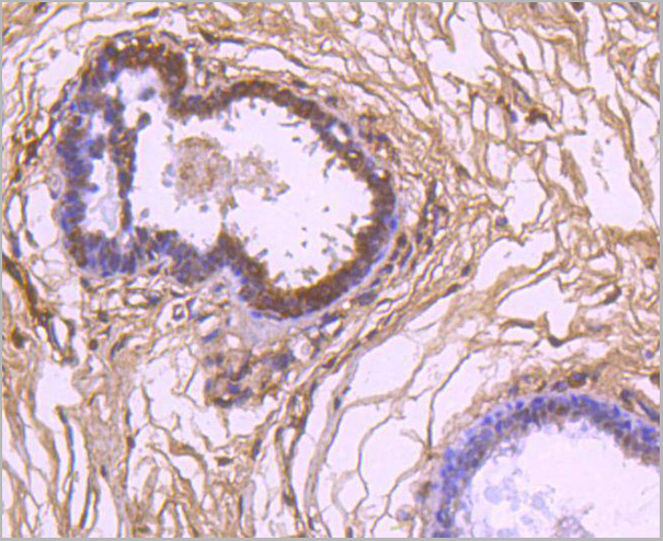product-image-AAA30018_IHC2.jpg