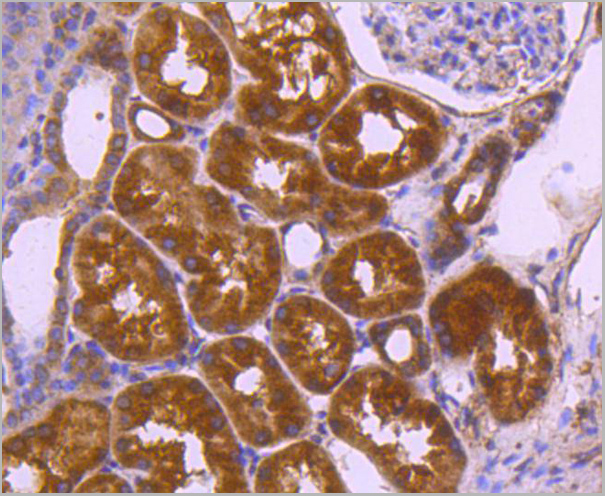 product-image-AAA30018_IHC3.jpg