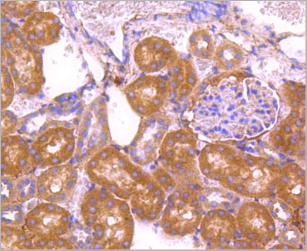 product-image-AAA30018_IHC4.jpg