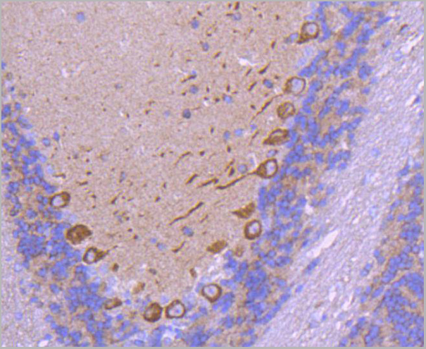 product-image-AAA30018_IHC5.jpg
