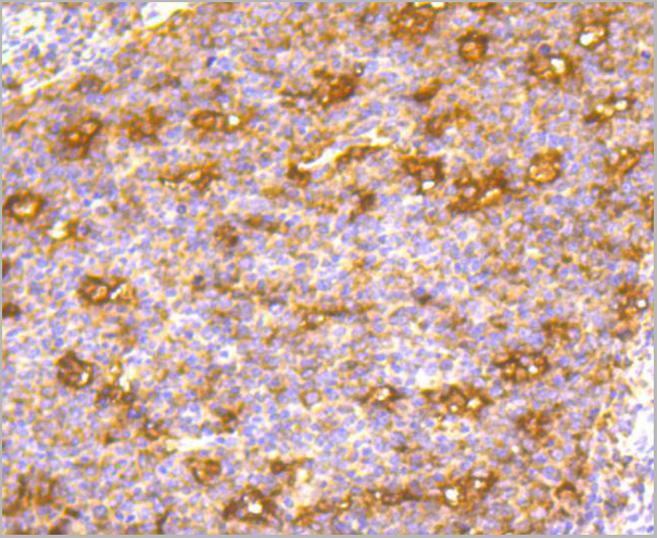 product-image-AAA30048_IHC2.jpg