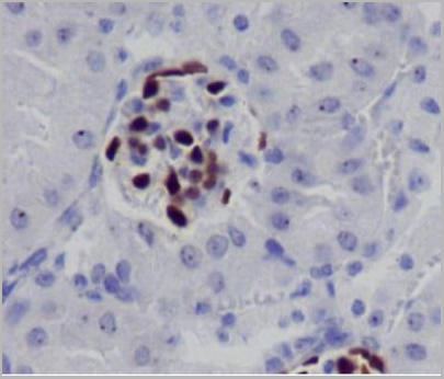 product-image-AAA30123_IHC4.jpg