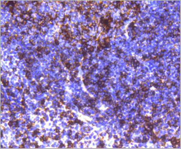product-image-AAA30136_IHC2.jpg