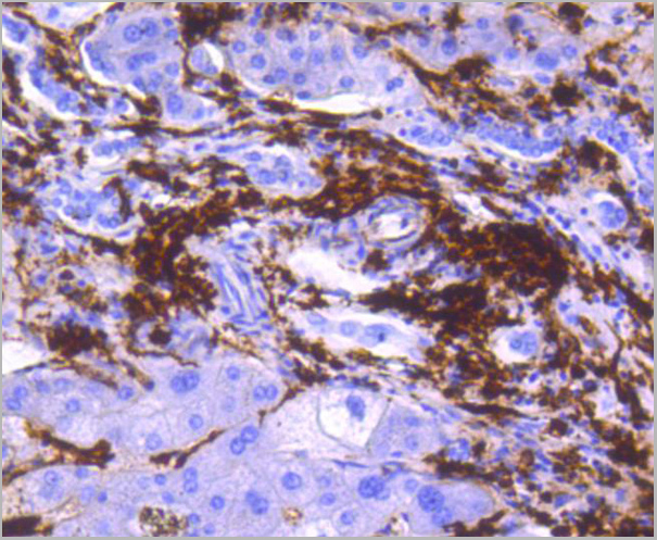 product-image-AAA30136_IHC3.jpg