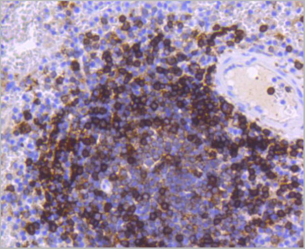 product-image-AAA30136_IHC4.jpg